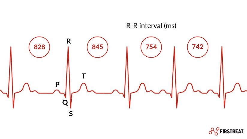 HRV RR Intervals 2